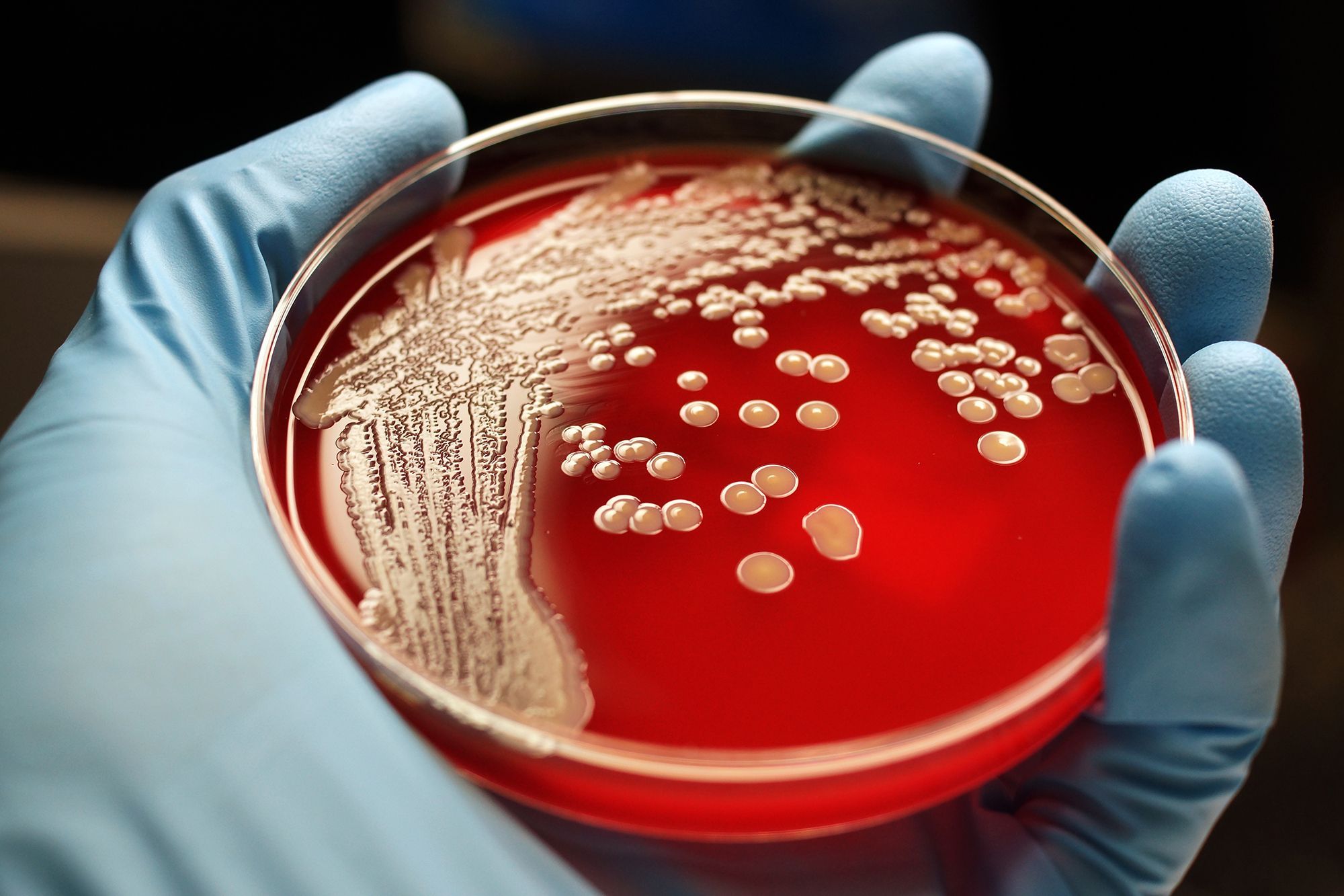 antibiotic-resistance-is-beefing-up-national-geographic-society