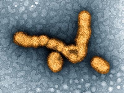 Particles of H1N1 influenza virus under a transmission electron microscope. This image has been digitally colorized to highlight the virus.