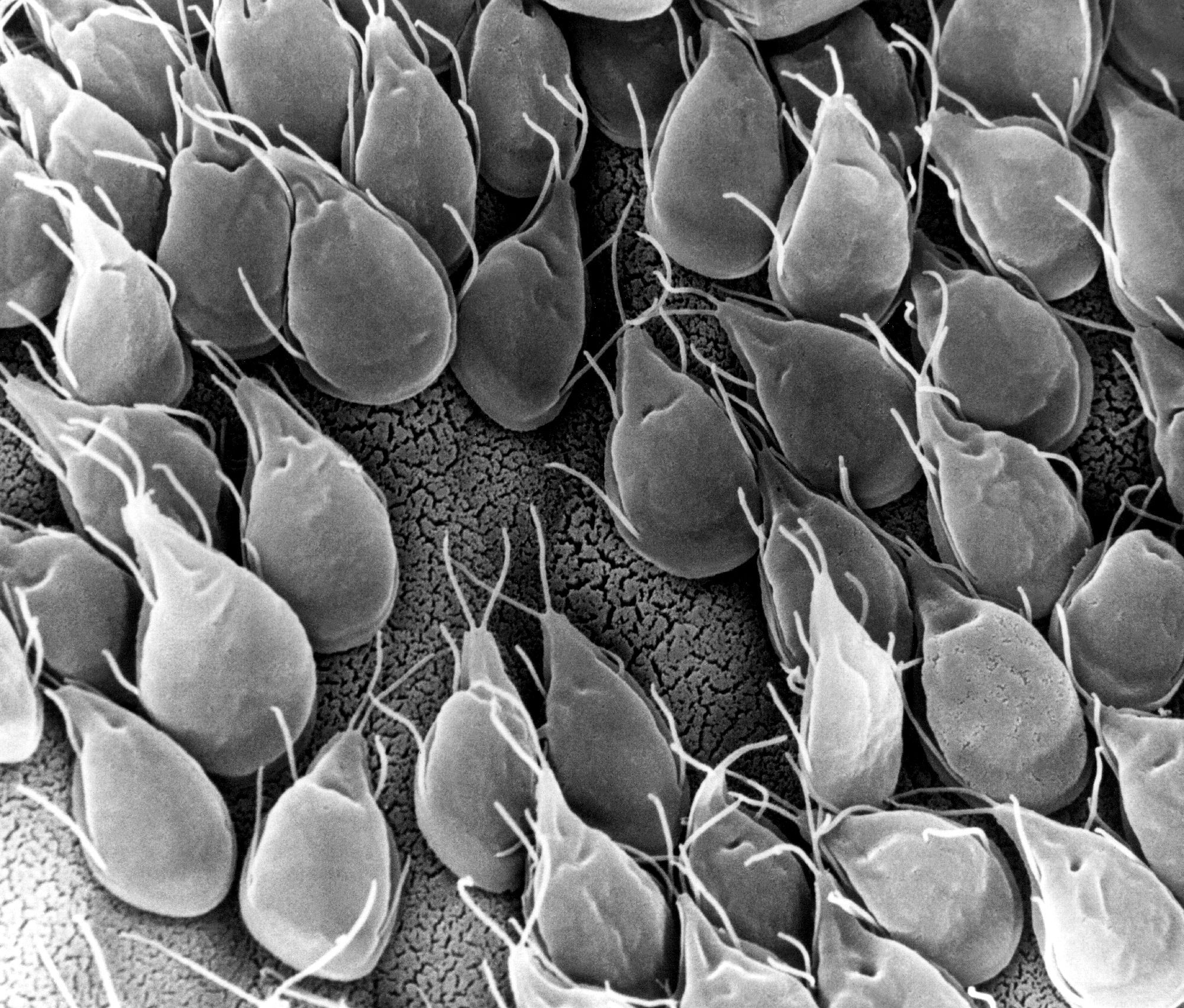 Naturista kezelés giardia és pinworms - A papilloma a paraziták jelenlétének jele